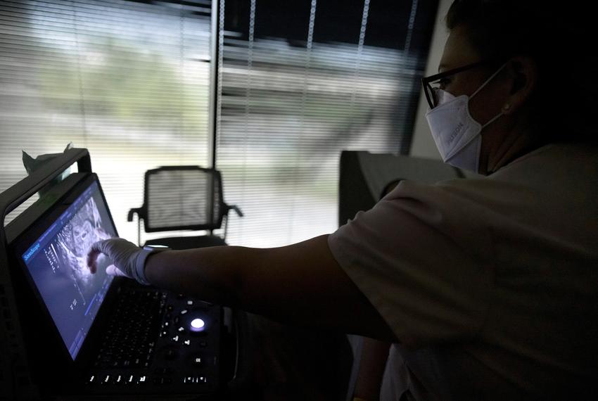 Catalina Leano, a licensed vocational nurse at Houston Women's Reproductive Services, performs an ultrasound with the clinic doctor present, to determine whether the woman is less than six weeks pregnant and eligible to have an abortion in Texas on Oct. 1, 2021.