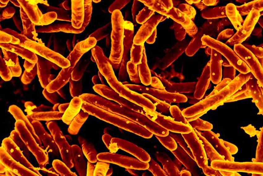 Scanning electron micrograph of Mycobacterium tuberculosis bacteria, which cause TB.