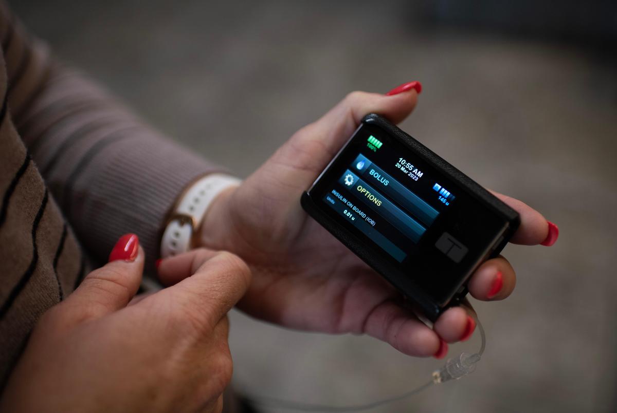 Nancy Shanafelt shows off her insulin pump that sends levels to the app on her phone March 20, 2023, in Groveton, Texas.