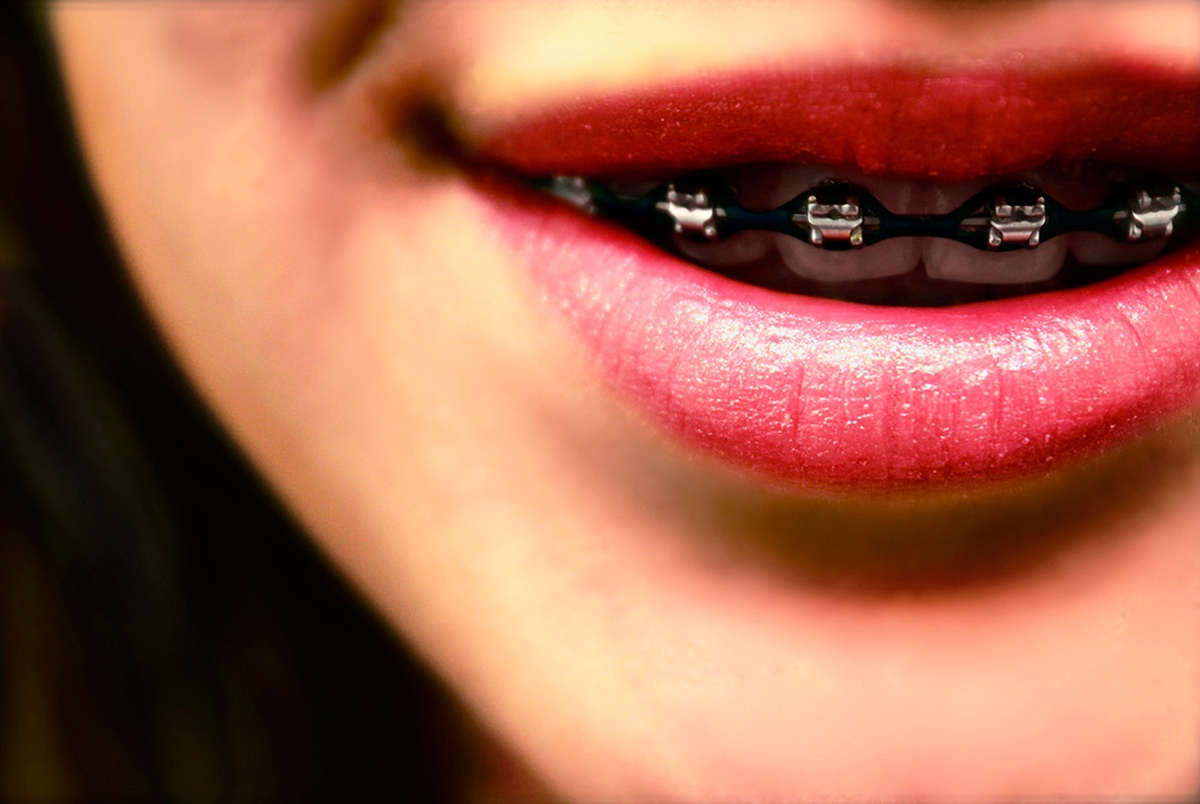 Medicaid Dental System An Ongoing Challenge The Texas Tribune