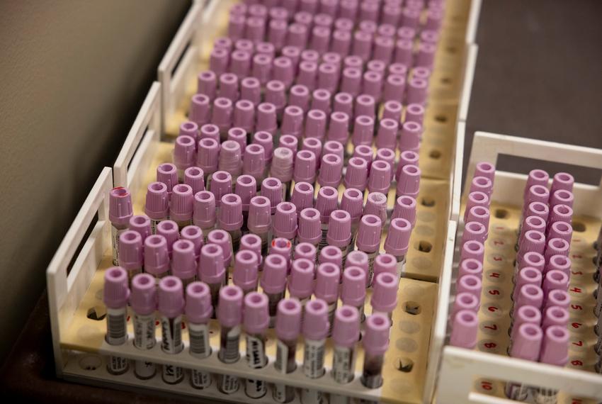 Patient blood samples seen on May 1, 2025 that are ready for testing at the Texas Department of State Health Services Laboratory.
